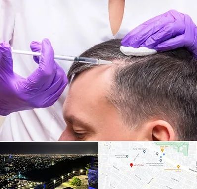 دکتر فوق تخصص پوست و مو در هفت تیر مشهد 