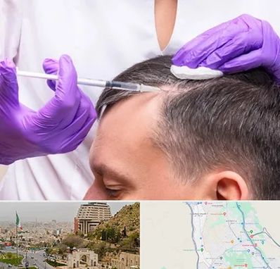 دکتر فوق تخصص پوست و مو در فرهنگ شهر شیراز 