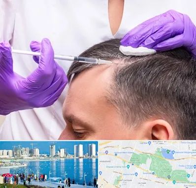 دکتر فوق تخصص پوست و مو در چیتگر 