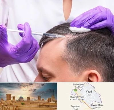 دکتر فوق تخصص پوست و مو در یزد