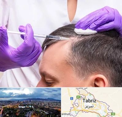 دکتر فوق تخصص پوست و مو در تبریز