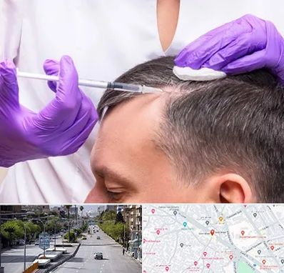 دکتر فوق تخصص پوست و مو در خیابان زند شیراز 