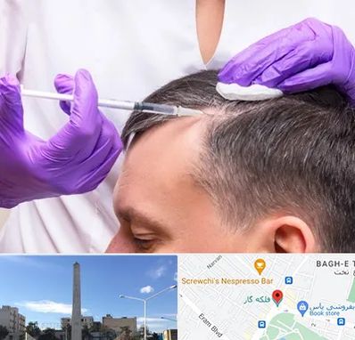 دکتر فوق تخصص پوست و مو در فلکه گاز شیراز 