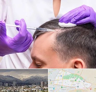 دکتر فوق تخصص پوست و مو در منطقه 4 تهران 