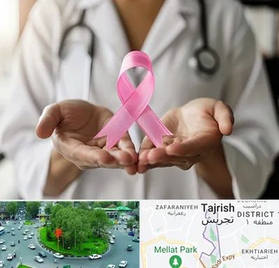 دکتر سرطان پستان در تجریش 