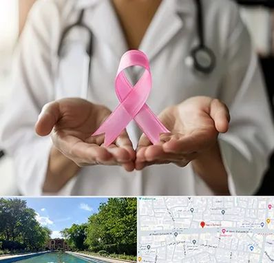 دکتر سرطان پستان در هشت بهشت اصفهان 