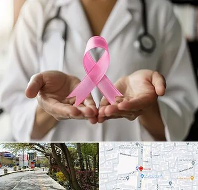 دکتر سرطان پستان در خیابان توحید اصفهان 