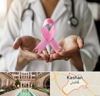 دکتر سرطان پستان در کاشان