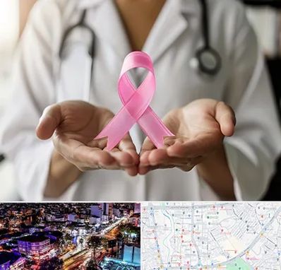 دکتر سرطان پستان در منظریه رشت 