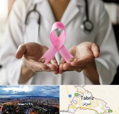 دکتر سرطان پستان در تبریز