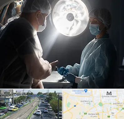 جراح سرطان مغز در جنوب تهران 