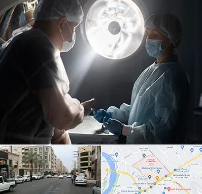 جراح سرطان مغز در زیتون کارمندی اهواز 