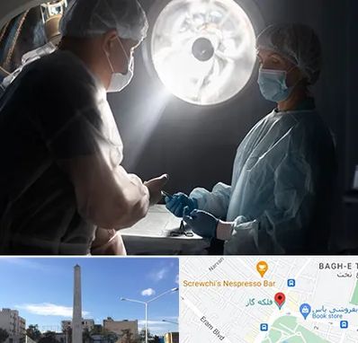 جراح سرطان مغز در فلکه گاز شیراز 