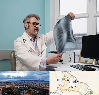 دکتر سرطان مغز و استخوان در تبریز