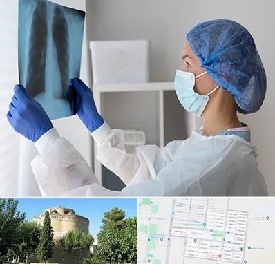 جراح سرطان مغز و استخوان در مرداویج اصفهان 