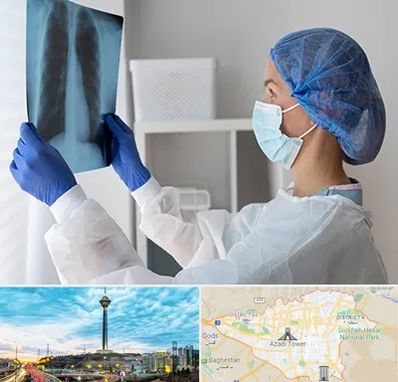 جراح سرطان مغز و استخوان در تهران