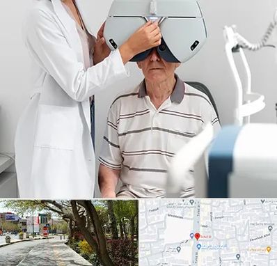 دکتر سرطان چشم در خیابان توحید اصفهان 