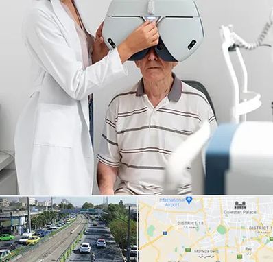 دکتر سرطان چشم در جنوب تهران 
