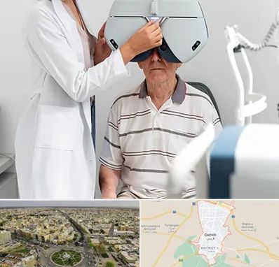 دکتر سرطان چشم در قزوین