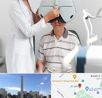 دکتر سرطان چشم در فلکه گاز شیراز 