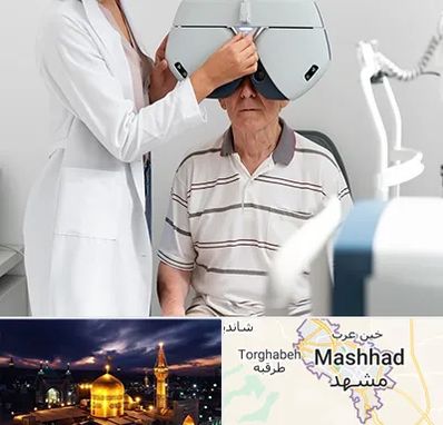 دکتر سرطان چشم در مشهد