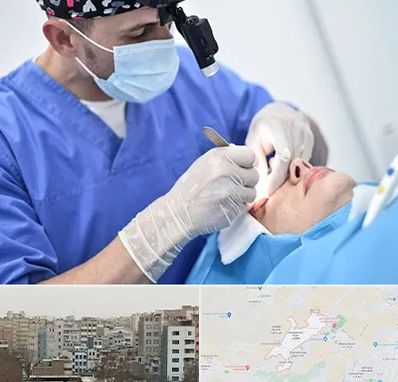 جراح سرطان چشم در محمد شهر کرج 