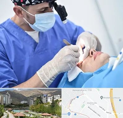 جراح سرطان چشم در شهر زیبا 
