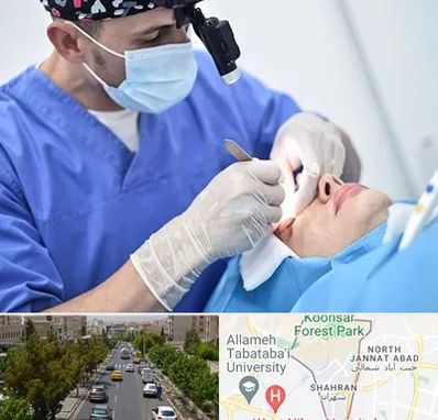 جراح سرطان چشم در شهران 