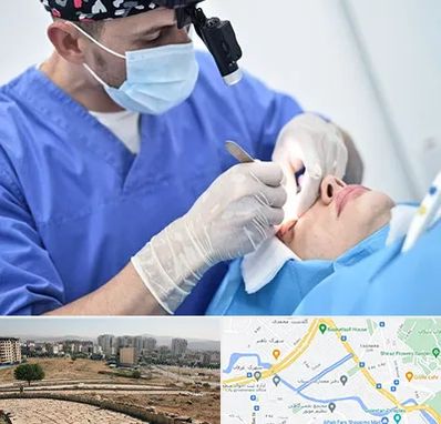 جراح سرطان چشم در کوی وحدت شیراز 