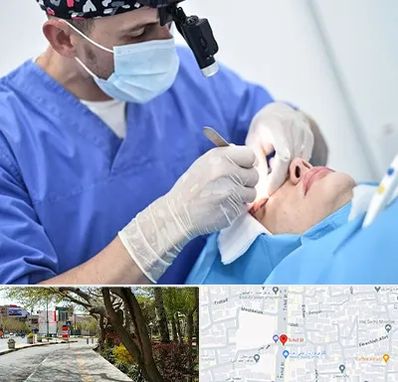 جراح سرطان چشم در خیابان توحید اصفهان 