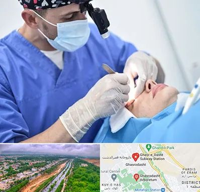 جراح سرطان چشم در قصرالدشت شیراز 
