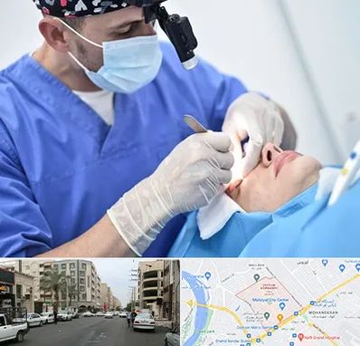 جراح سرطان چشم در زیتون کارمندی اهواز 