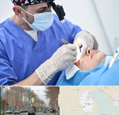جراح سرطان چشم در نظرآباد کرج 