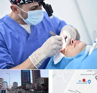 جراح سرطان چشم در چهارراه طالقانی کرج 