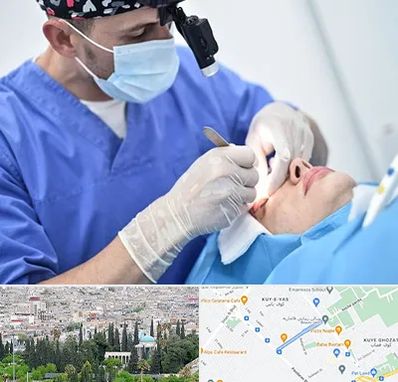 جراح سرطان چشم در محلاتی شیراز 
