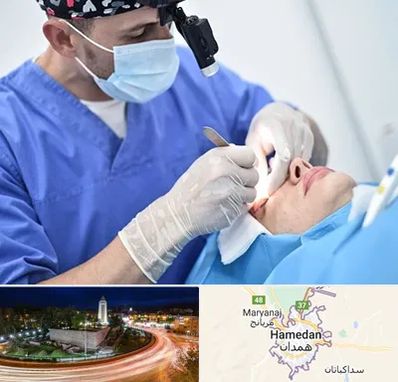 جراح سرطان چشم در همدان