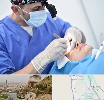 جراح سرطان چشم در فرهنگ شهر شیراز 