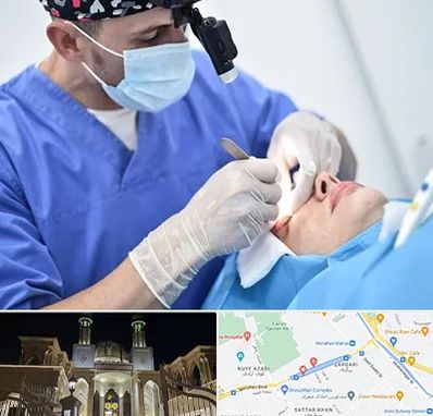 جراح سرطان چشم در زرگری شیراز 