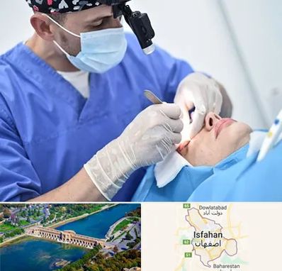 جراح سرطان چشم در اصفهان