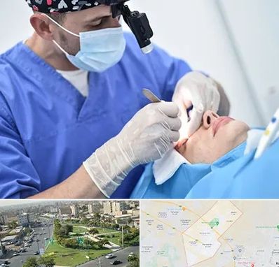 جراح سرطان چشم در کمال شهر کرج 