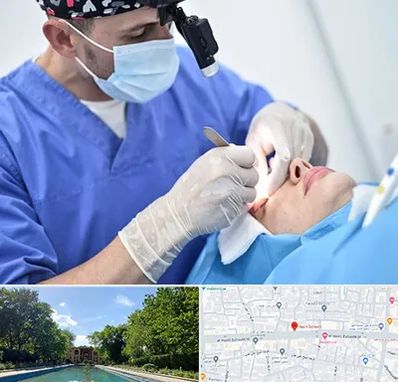 جراح سرطان چشم در هشت بهشت اصفهان 