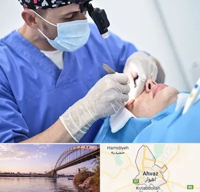 جراح سرطان چشم در اهواز