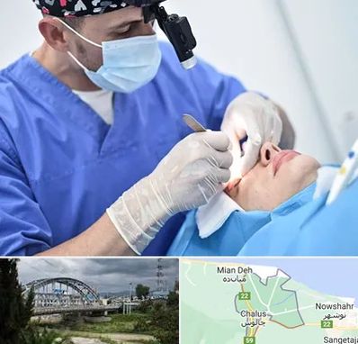 جراح سرطان چشم در چالوس