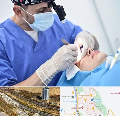 جراح سرطان چشم در خیابان نیایش شیراز 