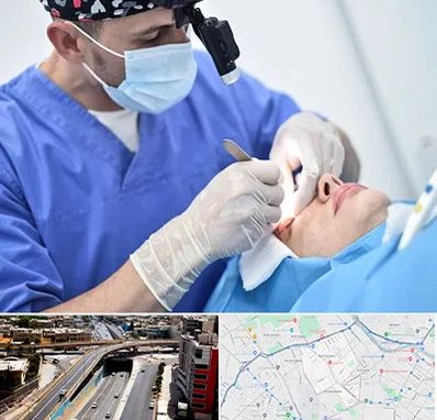 جراح سرطان چشم در ستارخان شیراز 