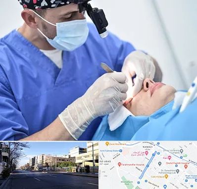 جراح سرطان چشم در خیابان ملاصدرا شیراز 