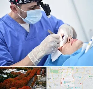 جراح سرطان چشم در منطقه 6 تهران 