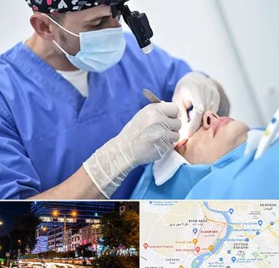 جراح سرطان چشم در کیانپارس اهواز 