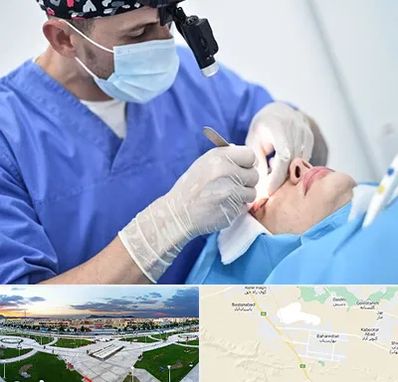 جراح سرطان چشم در بهارستان اصفهان 