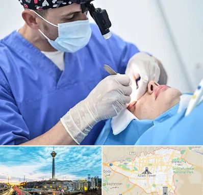 جراح سرطان چشم در تهران